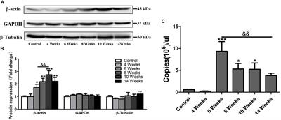 Frontiers Actin Not a Suitable Internal Control of Hepatic